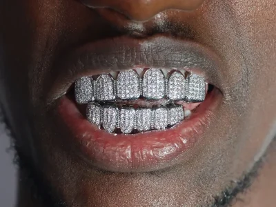 ice out grillz